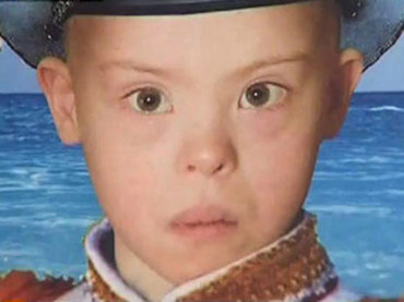8-yr-old-with-Down-syndrome-dies-after-t